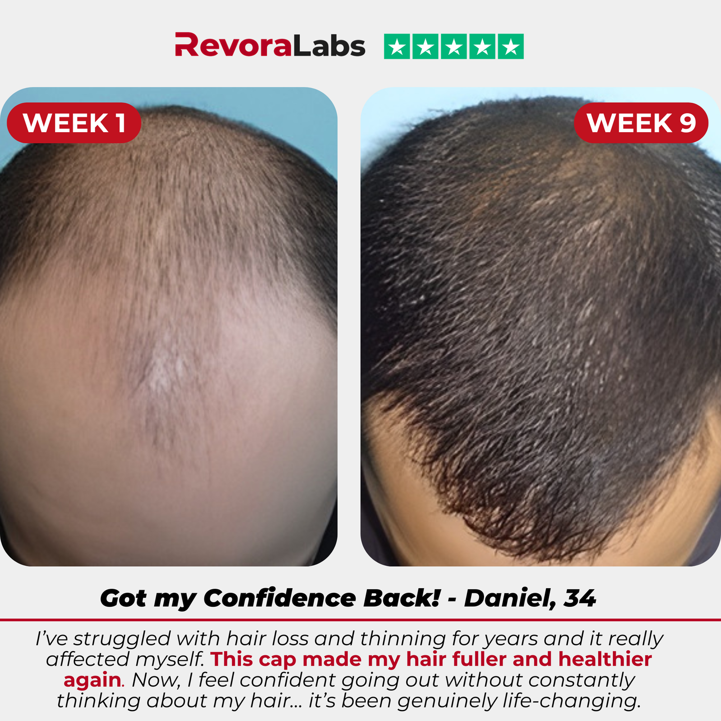 RevoraLabs™ Red Light Therapy Cap